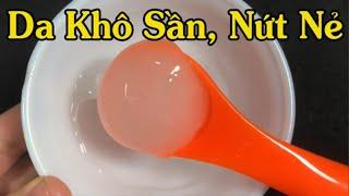 CÁCH TRỊ DA BỊ BONG TRÓC NỨT NẺ TẠI NHÀ HIỆU QUẢ NHẤT