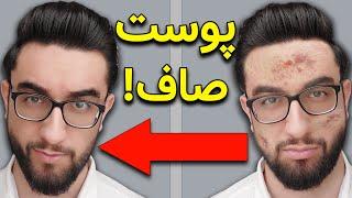 مراقبت از پوست  چجوری سریع به پوست صاف برسیم فقط در سه مرحله