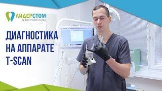 Диагностика на аппарате T Scan.   Выявление нарушения прикуса