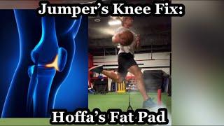 Jumper’s Knee Hoffa’s Fat Pad Fix Patellar Tendon Pain
