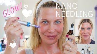 ️Nano Needling  How to needle at home for SERIOUS glow