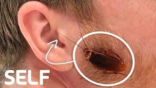 Can a Cockroach Get Stuck in Your Ear?  How Common Is It?  SELF