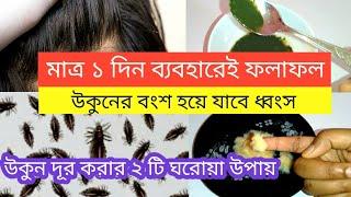 উকুনের বংশ করুন একেবারেই ধ্বংশ  উকুন দূর করার উপায়  remove lice from hair naturally