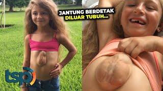 Gadis Ini Lahir dengan Kondisi Jantung Diluar Tubuh Namun Tetap Bahagia