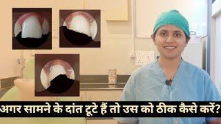 How to repair cracked front Tooth? l सामने के दांत अगर टूटे है तो उस को ठीक कैसे करें?