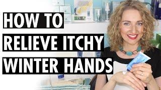 How to Relieve Itchy Winter Hands