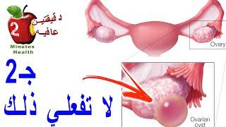 علاج تكيس المبايض بالاعشاب مضمون ١٠٠%