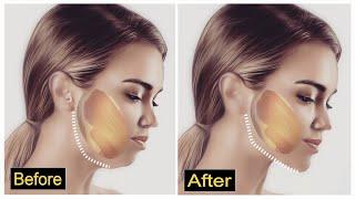  Beautiful Jaw Line in No Time  Take Years Off Your Face. 100% FAST RESULT  Anti-Aging.