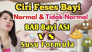 Ciri feses bayi normal vs tidak normal dan feses bayi ASI dan susu formula