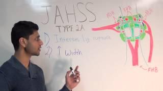 Jahss 1st MTP Dislocation - Anatomy and Biomechanics