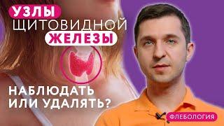 Как лечить узлы щитовидной железы?  #клиникащербатовой #щитовидка #щитовиднаяжелеза