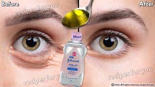In 3 days Remove Under Eye Bags Completely  Remove Dark Circles Wrinkles and Puffy Eyes