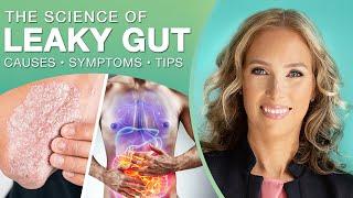 The Science of Leaky Gut  Everything You Need to know About Leaky Gut