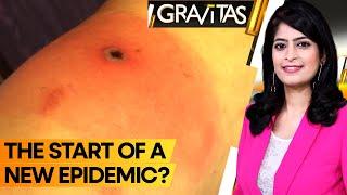 Gravitas  Alaskapox The new killer virus claims its first victim