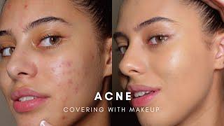 HOW TO COVER ACNE WITH MAKEUP BASE ROUTINE