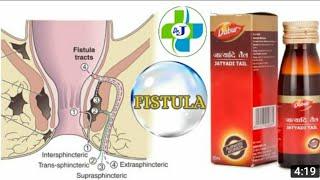 #Dabur Jatyadi Tail how to use in Burning Piles Fistula and Fissure relief treatment review 2022