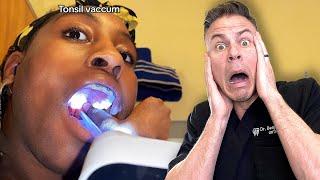 How To ACTUALLY Remove Your Tonsil Stones