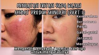 MENGATASI IRITASI PADA WAJAH AKIBAT PRODUK SKINCARE