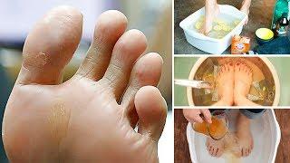 How to Get Rid of Smelly Feet for Good