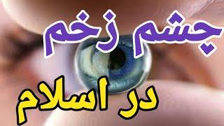 چشم زخم در اسلامدعای دفع چشم زخمبررسی چشم زخم از نظر قرآن و علم
