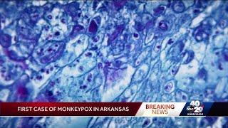 Arkansas Department of Health identifies states first case of monkeypox