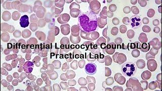 Differential Leucocyte Count DLC Practical Lab