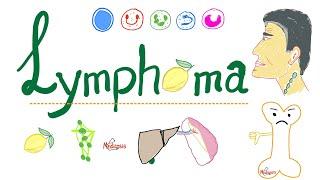 Lymphoma Introduction - Painless Enlarged Lymph Node - Hematology and Oncology Series