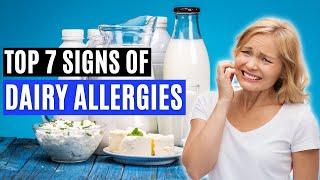 Top 7 Signs of a Dairy Allergy Signs of CMPA