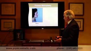 Finesse Rhinoplasty by Dr. Mark Prysi - Naples Florida