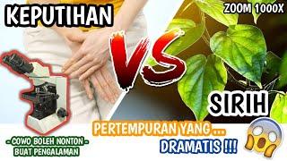 ZOOM 1000X  JAMUR GATAL KEPUTIHAN WANITA VS DAUN SIRIH