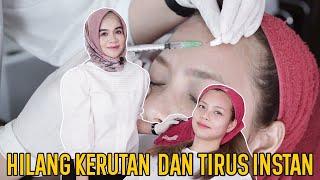 BOTOX WAJAH TAHAN BERAPA LAMA??