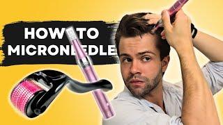 Derma Roller vs. Derma Pen  How to Microoneedle for Hair Loss