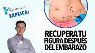 ¿Cómo recuperar la figura después del embarazo? 