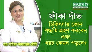 ফাঁকা দাঁতের চিকিৎসা ও খরচ  Faka Dater Treatment & Cost  Gap Between Teeth Treatment & Cost