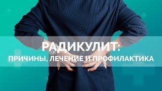 Радикулит причины лечение и профилактика