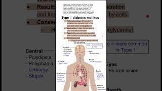 Type 1 diabetes mellitus