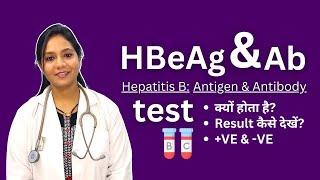 HBeAg and Antibodies Test in Hindi  Positive Negative Result Analysis