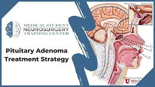 Pituitary Adenoma Treatment Strategy