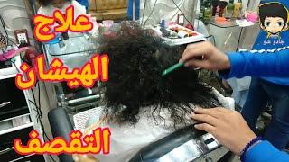 حل مشكلة هيشان الشعر والتقصف  النصيحة لله والخظا بسببك