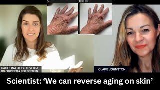 Scientist on how topical supplement ‘reverses aging’ on our skin  Interview with OneSkin founder