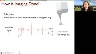 Basics of ultrasound imaging