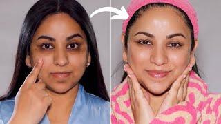 How I got rid of HYPERPIGMENTATION with this simple change to my routine