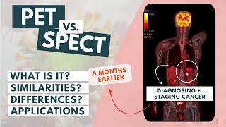 PET vs SPECT  The basics Updated video