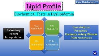 17 Lipid Profile  Biochemical tests in Dyslipidemia  Lipid Metabolism-17  Biochemistry