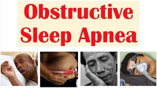 Obstructive Sleep Apnea OSA  Risk Factors Signs & Symptoms Complications Diagnosis Treatment