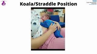 Koala  Straddle breastfeeding position