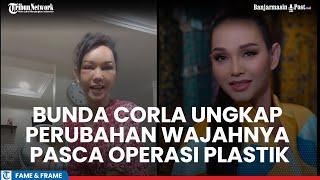 Bunda Corla Syok Lihat Perubahan Wajahnya Pasca Operasi Plastik dengan Biaya Rp 15 M