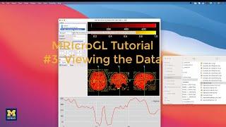 MRIcroGL Tutorial #3 Viewing Data