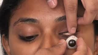 Artificial eye removal with suction cup