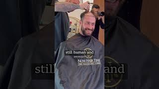 Chris Bumstead is Balding and decides to go for a hair transplant...  #bodybuilding #shorts